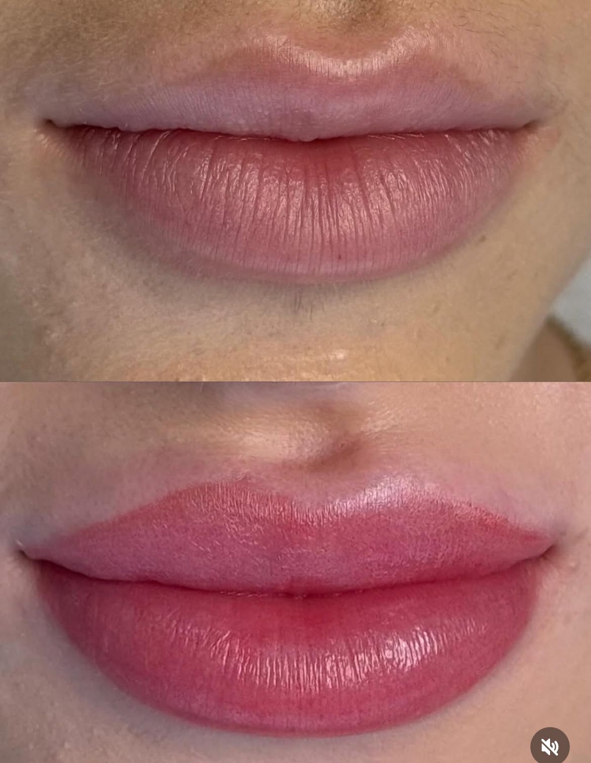 Antes e depois micropigmentação labial