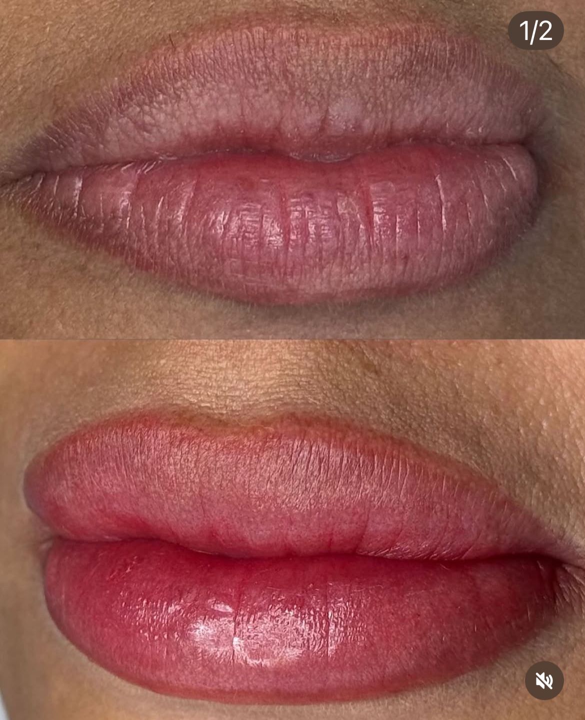 Antes e depois micropigmentação labial