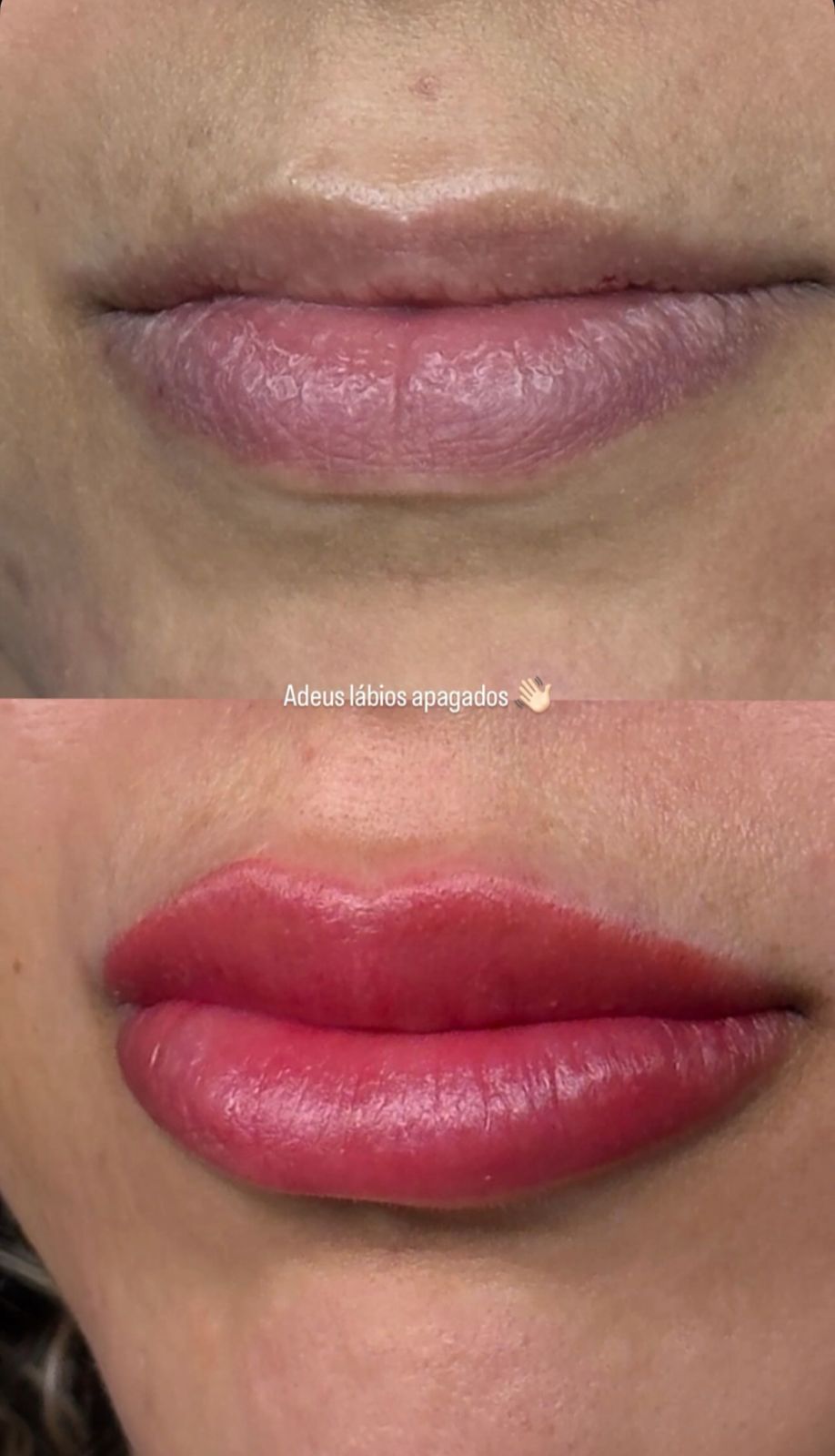 Adeus lábios apagados — antes e depois